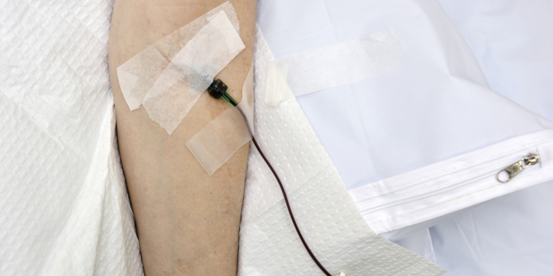 Umbilical Cord Stem Cells + Ozone Therapy: A Next-Generation Regenerative Treatment